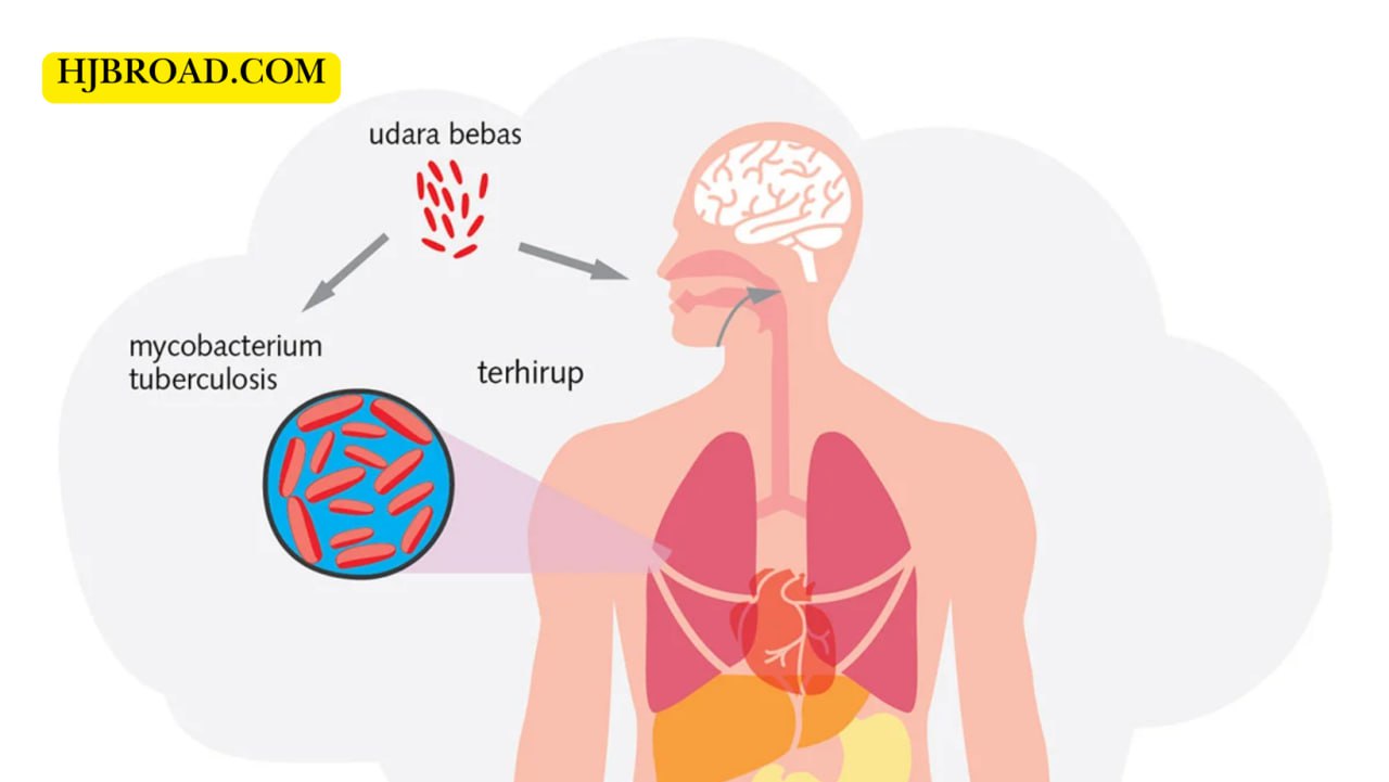 WHO dan Upaya Global Mengendalikan Penyakit Menular